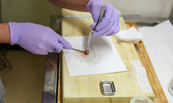 リンパ節を2mm間隔に切ります。