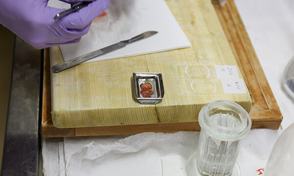 コンパウンドという透明なゼリー状のものに検体を埋め込みます。