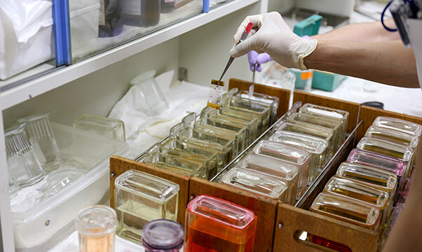 薄く切った検体をHE染色で色付けします。